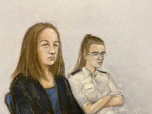 Supporting image for story: Consultant tells trial skin marks ‘didn’t fit with anything he’d seen’