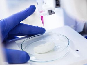 Supporting image for story: A Swedish company is working on technology to 3D print human organs