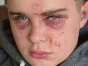 Supporting image for story: Eight people arrested after three assaults in Newtown