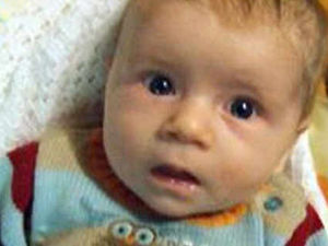 Supporting image for story: Baby in dog attack is back home