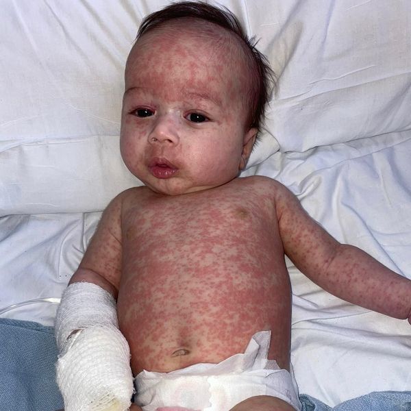 Ezra Barrett à l'hôpital à l'âge de 10 mois.
