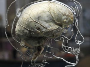 Supporting image for story: Poor navigation could predict Alzheimer’s years before symptoms appear – study
