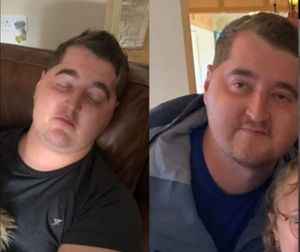 Scott Hinch during treatment