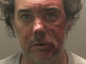 Supporting image for story: Man jailed for murdering partner who died two years after he set her alight