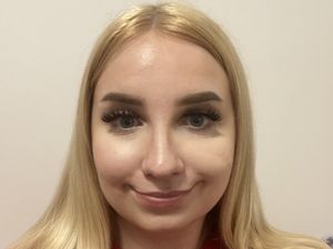 Supporting image for story: Student from Wem advocating for normalisation and embracing visible differences