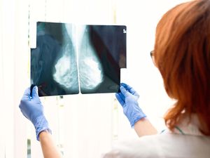 Supporting image for story: Drug slashes risk of death for women with high-risk breast cancer by 32%