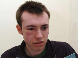 Supporting image for story: Player's jaw broken in soccer pitch brawl