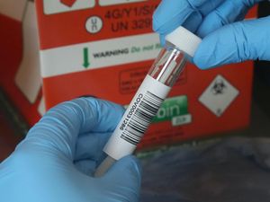 Supporting image for story: Two new coronavirus testing ‘megalabs’ set to open in early 2021