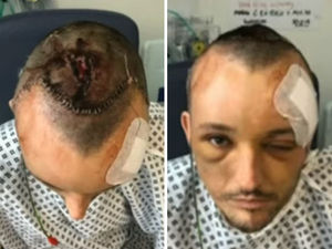 Supporting image for story: 'He landed on the crossing': Father suffers horrific injuries in Stourbridge hit-and-run