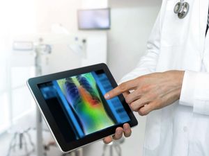 Doctor using AI algorithm and machine learning to detect pneumonia