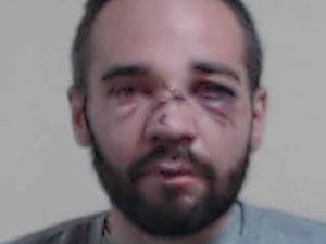 Handout mugshot of Finlay MacDonald, with injuries on his face