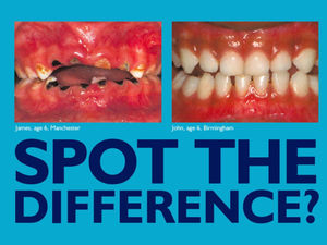 Supporting image for story: Should we still be adding chemical to West Midlands water to tackle tooth decay?