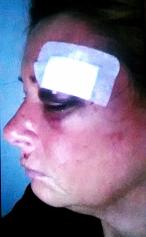 Lorraine Hill's injuries after the attack