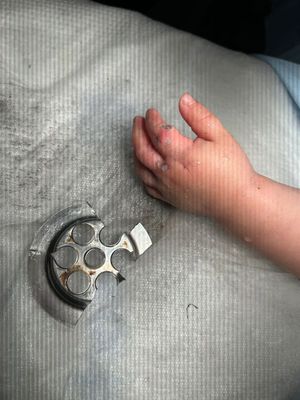 The toddler's hand with the offending plug