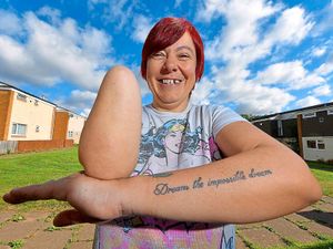 Supporting image for story: £30,000 bionic hand would change Telford mum's life - with video