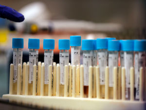 Supporting image for story: Coronavirus: 28 more deaths in Black Country, Staffordshire and Birmingham