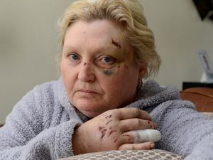 Supporting image for story: Woman run over by son's stolen Audi during terrifying Black Country robbery 