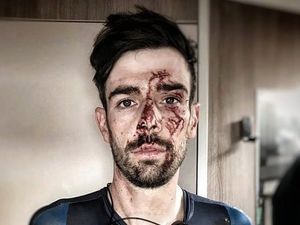 Supporting image for story: Wolverhampton's Andy Tennant shakes off nasty injury for Tour of Britain stage three